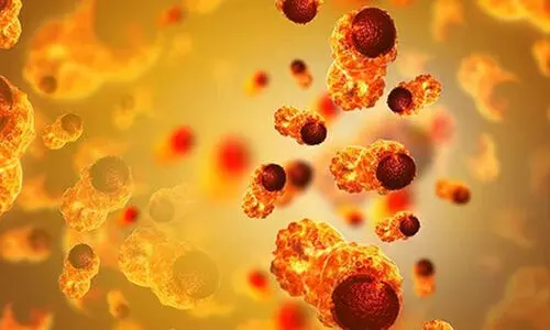 യുവജനങ്ങളിൽ അർബുദ ബാധ കൂടുന്നതായി ഐ.സി.എം.ആർ പഠനം; കൂ​ടു​ത​ൽ സ്ത്രീ​ക​ളി​ൽ