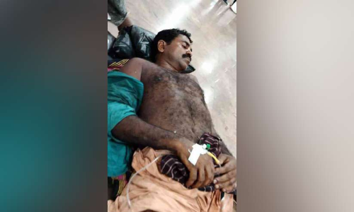 ഭാര്യയുടെ ബന്ധുക്കള്‍ ഭര്‍ത്താവിനെ വെട്ടിപ്പരിക്കേല്‍പ്പിച്ചു