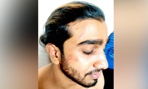 വിദ്യാർഥിയെ മർദിച്ചെന്ന് പരാതി