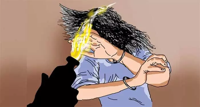 കോഴിക്കോട് ആസിഡാക്രമണത്തിൽ യുവതിക്ക് ഗുരുതരമായി പൊള്ളലേറ്റു; യുവാവ് കസ്റ്റഡിയിൽ