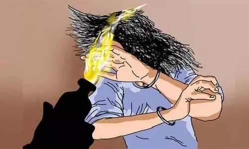 കോഴിക്കോട് ആസിഡാക്രമണത്തിൽ യുവതിക്ക് ഗുരുതരമായി പൊള്ളലേറ്റു; യുവാവ് കസ്റ്റഡിയിൽ