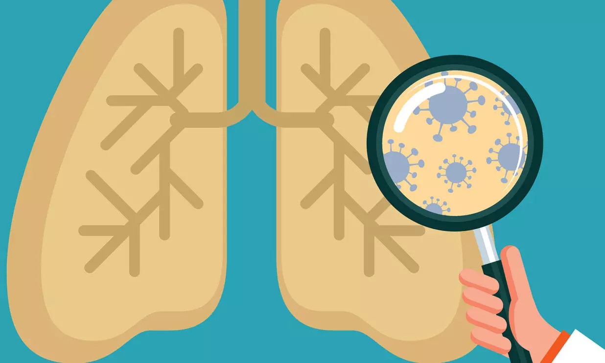 ക്ഷയരോഗ നിവാരണം; ദേശീയതലത്തിൽ വയനാടിന് സുവര്‍ണനേട്ടം
