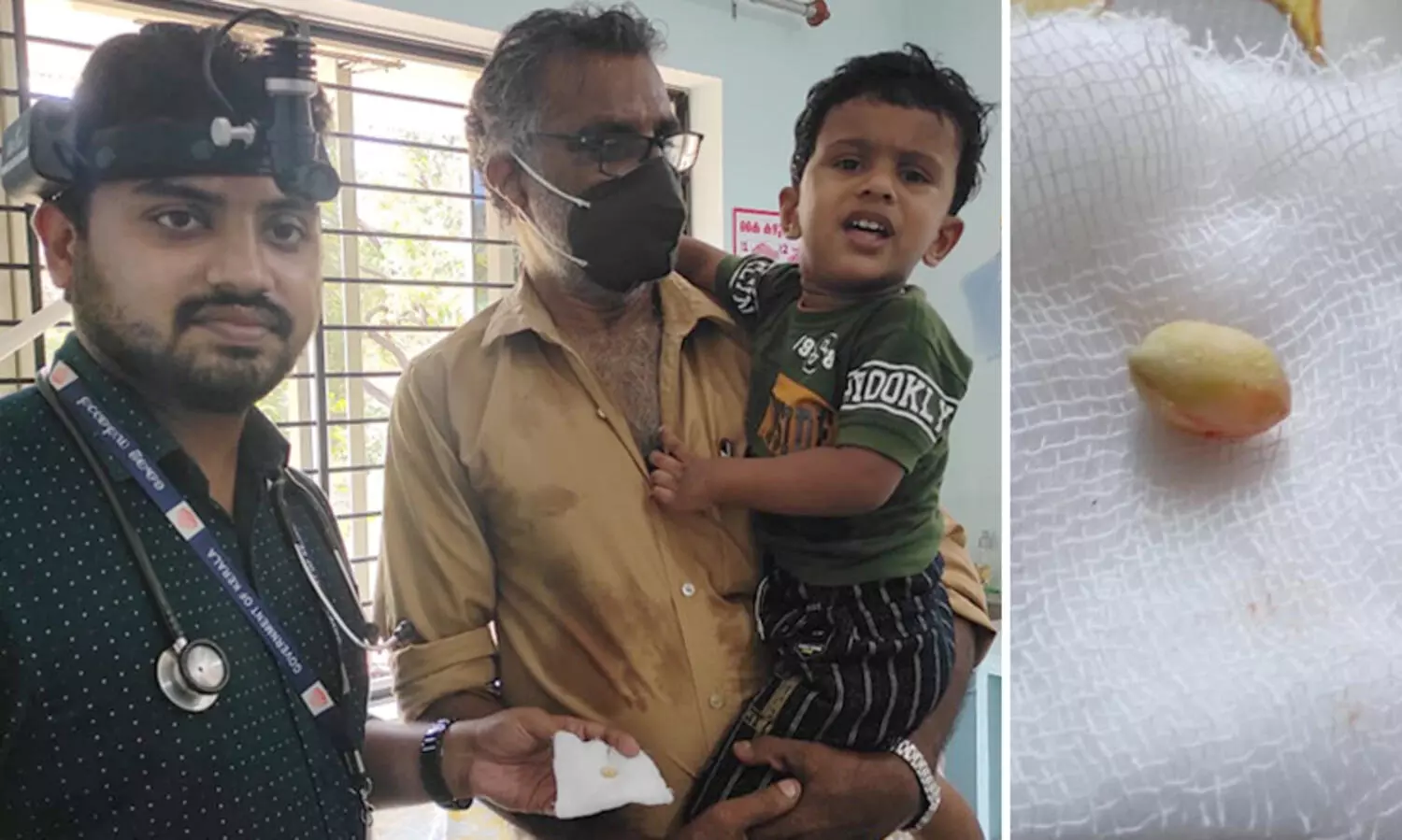 മൂക്കിനുള്ളിൽ നിലക്കടല കുടുങ്ങി; രണ്ടു വയസ്സുകാരന് കുടുംബാരോഗ്യ കേന്ദ്രത്തിലെ ഡോക്ടർ രക്ഷകനായി