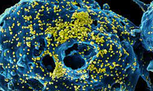 ഖത്തറിൽ ​മെർസ്​ സ്ഥിരീകരിച്ചു; ഒട്ടകങ്ങളുമായി സമ്പർക്കമുള്ള 50കാരനാണ്​ രോഗബാധ