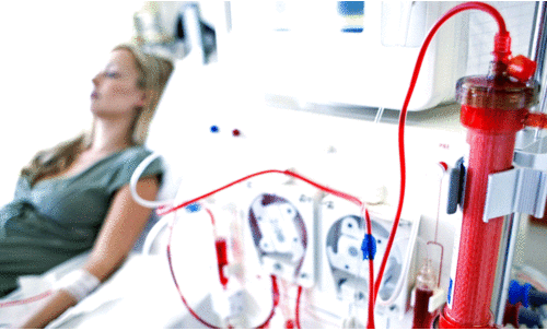 വൃക്കരോഗികളുടെ വർധന: ഡയാലിസിസ് സേവനം വർധിപ്പിച്ച് എച്ച്.എം.സി