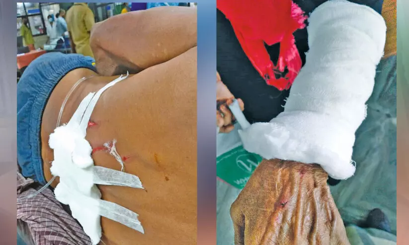 കാട്ടുപന്നി ആക്രമണം; നാലുപേർക്ക് പരിക്ക്