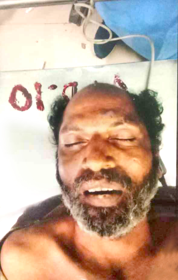 ബ​സ് കാ​ലി​ൽ ക​യ​റി​യി​റ​ങ്ങി പ​രി​ക്കേ​റ്റ​യാ​ൾ മ​രി​ച്ചു