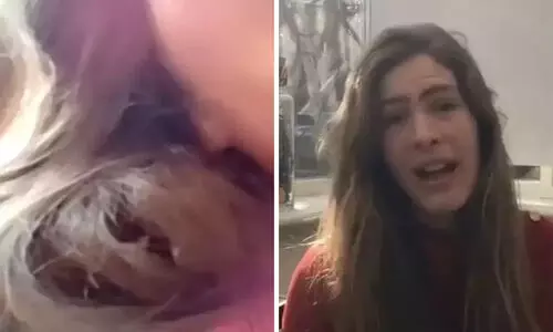 പക്ഷിക്കുഞ്ഞ് തന്‍റെ മുടിയിൽ കൂടുകൂട്ടിയെന്ന് യുവതി; അതും 84 ദിവസം!