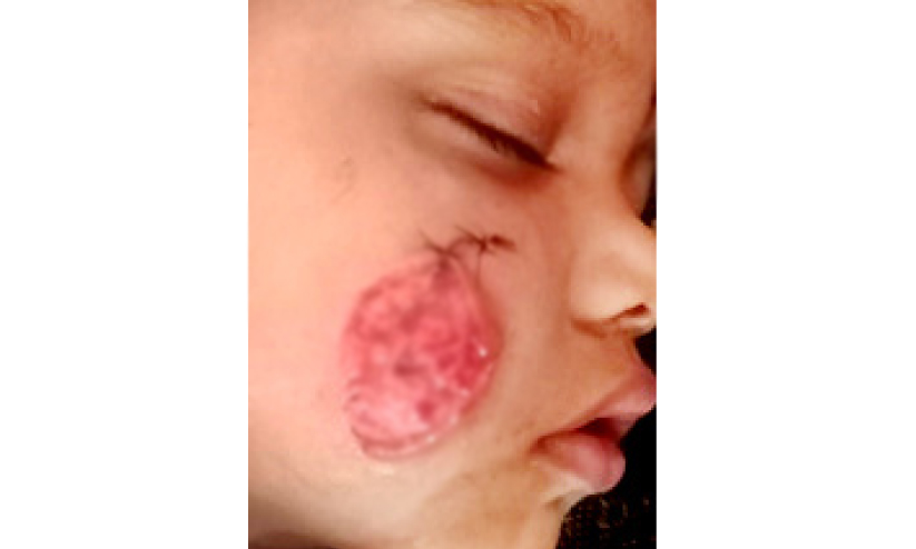 കനിയണം, ഈ കുഞ്ഞുമുഖത്ത് പുഞ്ചിരി വിടരാൻ... കനിയണം, ഈ കുഞ്ഞുമുഖത്ത് പുഞ്ചിരി വിടരാൻ...