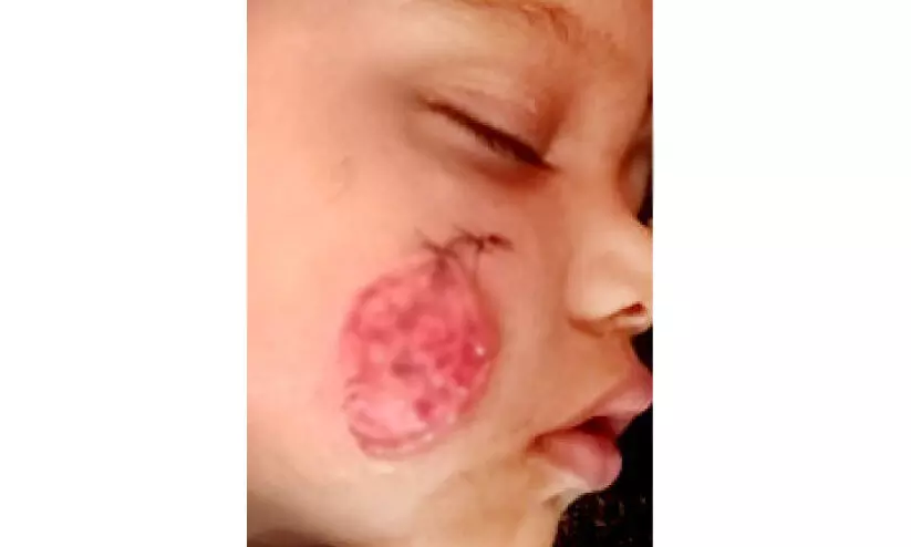 കനിയണം, ഈ കുഞ്ഞുമുഖത്ത് പുഞ്ചിരി വിടരാൻ...