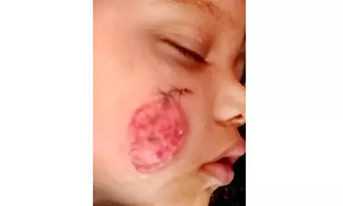 കനിയണം, ഈ കുഞ്ഞുമുഖത്ത് പുഞ്ചിരി വിടരാൻ...