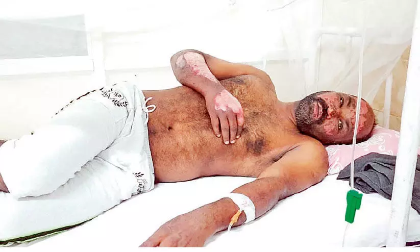 തീപിടിച്ച ഗ്യാസ് സിലിണ്ടർ പുറത്തേക്കിട്ട് യുവാവ്; ഒഴിവാക്കിയത് വൻ ദുരന്തം