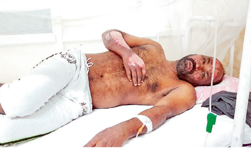 തീപിടിച്ച ഗ്യാസ് സിലിണ്ടർ പുറത്തേക്കിട്ട് യുവാവ്; ഒഴിവാക്കിയത് വൻ ദുരന്തം