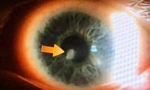 ഭാര്യയുടെ കണ്ണ് അടിച്ച് പൊട്ടിച്ച് കാഴ്ച നഷ്ടപ്പെടുത്തി; ഭർത്താവിന് ഏഴു വർഷം കഠിനതടവും പിഴയും