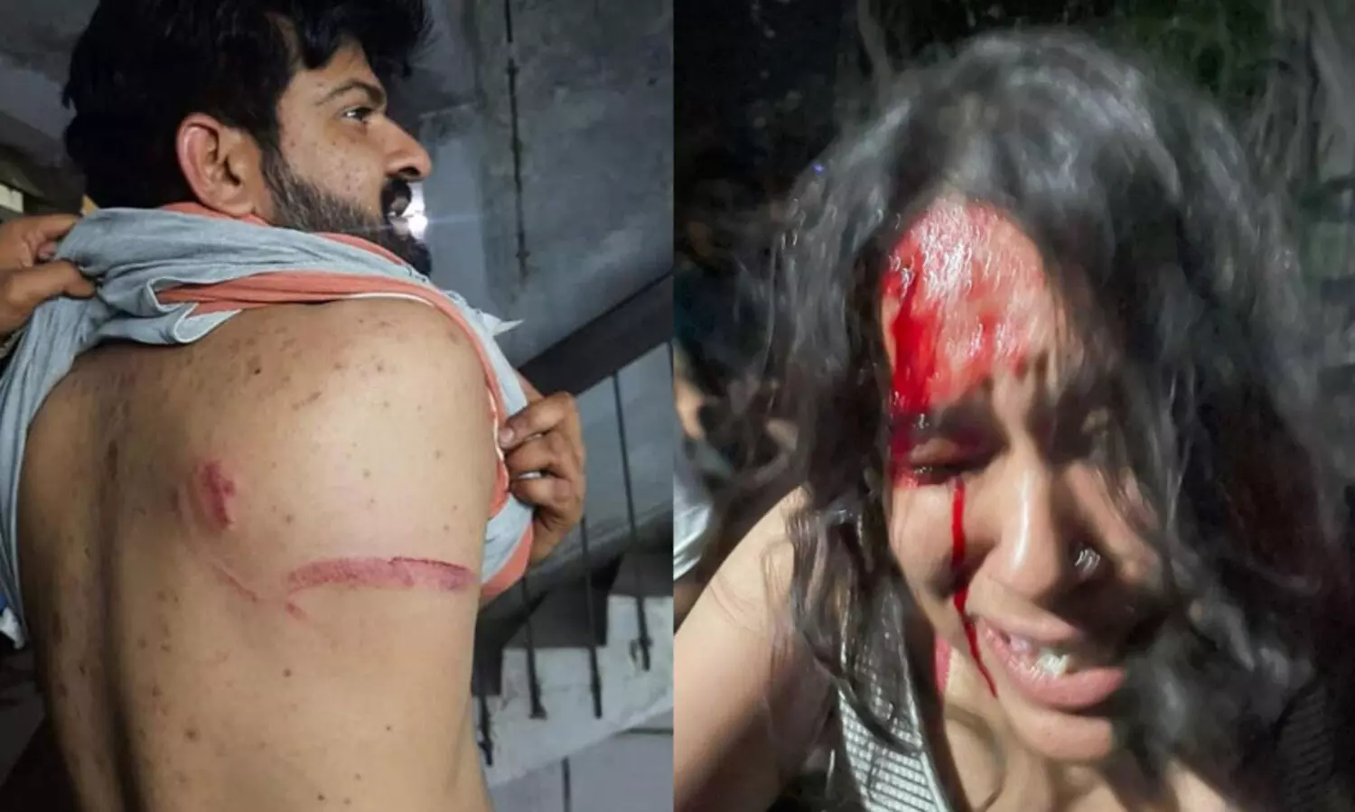 ജെ.എൻ.യുവിൽ മാംസഭക്ഷണം തടഞ്ഞ് എ.ബി.വി.പി പ്രവർത്തകരുടെ ആക്രമണം