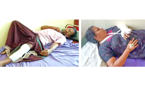 ജല അതോറിറ്റി വെട്ടിയ കുഴിയിൽ ഓട്ടോമറിഞ്ഞ് ദമ്പതികൾക്ക് പരിക്ക്