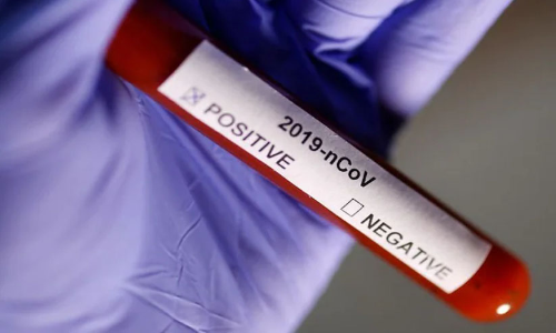 505 ദിവസം നീണ്ടുനിന്ന് കോവിഡ് അണുബാധ; റിപ്പോർട്ട് ചെയ്തതിൽ ഏറ്റവും ദൈർഘ്യമേറിയതെന്ന് ഗവേഷകർ