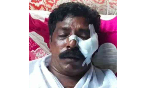 വർക്കലയിൽ ലഹരി മാഫിയ ആക്രമണം; ചുമട്ടുതൊഴിലാളിക്ക് വെട്ടേറ്റു