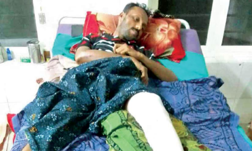 കാട്ടുപന്നി ഓട്ടോയിലിടിച്ച്യുവാവിന് പരിക്ക്