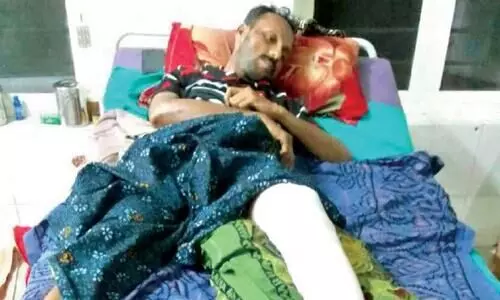 കാട്ടുപന്നി ഓട്ടോയിലിടിച്ച്യുവാവിന് പരിക്ക്