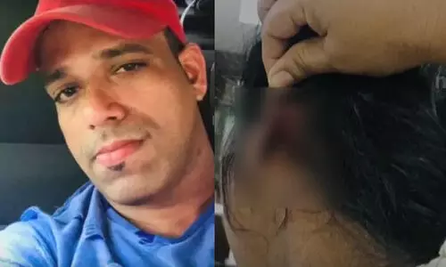 സൈക്കിൾ ചോദിച്ചതിന് മകളുടെ കൈ ഒടിച്ചു, ഭാര്യയുടെ ചെവി കടിച്ചു; പ്രതി ഇപ്പോഴും ഒളിവില്‍