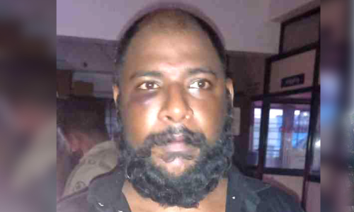 Karukutty Bar Attack