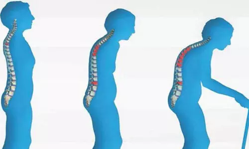 ഓസ്റ്റിയോപെറോസിസ് നിങ്ങളിലുമുണ്ടാകാം നിശ്ശബ്ദമായി