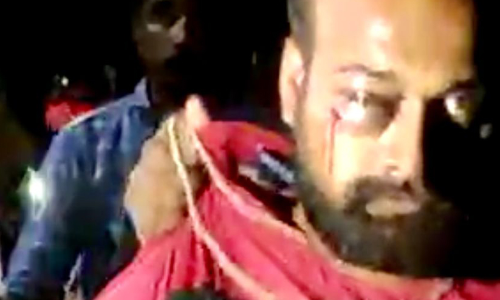 പിടിയിലായ ആർ.എസ്.എസ് പ്രവർത്തകർക്കെതിരെ കൊലപാതക ശ്രമത്തിന് കേസ്; എസ്.ഡി.പി.ഐ നേതാവിനെ വധിക്കാൻ ശ്രമിച്ചെന്ന് എഫ്.ഐ.ആർ