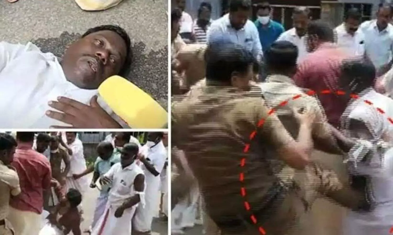 കെ-റെയിൽ പ്രതിഷേധത്തിനിടെ ചവിട്ടേറ്റയാൾ പൊലീസുകാരനെതിരെ പരാതി നൽകി