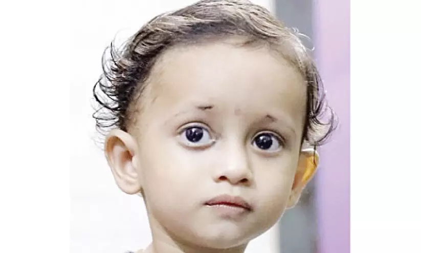 അപൂർവ രോഗവുമായി രണ്ടു വയസ്സുകാരൻ സുമനസ്സുകളുടെ സഹായം തേടുന്നു