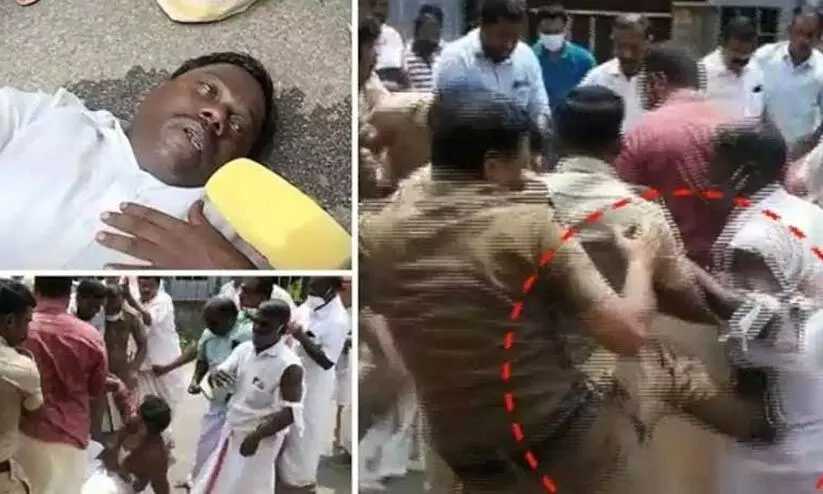 കെ-റെയിൽ പ്രതിഷേധത്തിനിടെ ചവിട്ടേറ്റയാൾ പൊലീസുകാരനെതിരെ പരാതി നൽകി