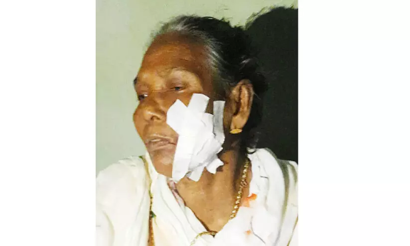 തെരുവുനായുടെ ആക്രമണത്തിൽ വീട്ടമ്മക്ക് പരിക്ക് തെരുവുനായുടെ ആക്രമണത്തിൽ വീട്ടമ്മക്ക് പരിക്ക്