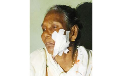 തെരുവുനായുടെ ആക്രമണത്തിൽ വീട്ടമ്മക്ക് പരിക്ക് തെരുവുനായുടെ ആക്രമണത്തിൽ വീട്ടമ്മക്ക് പരിക്ക്