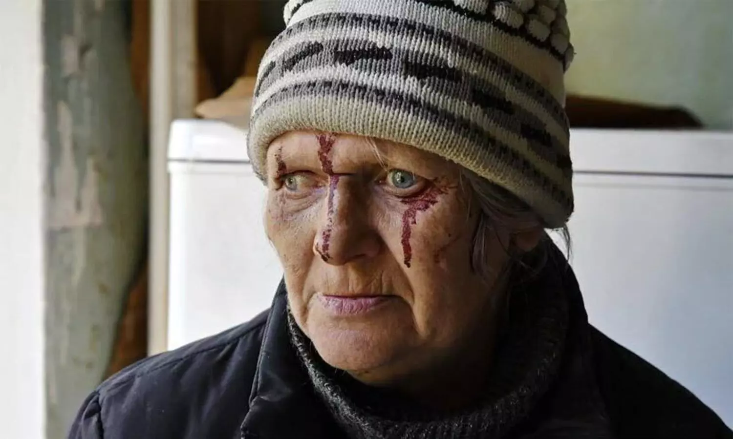 റഷ്യയെ യുദ്ധകുറ്റ നിയമത്തിന് മുന്നിൽ കൊണ്ടുവരണമെന്ന് ആംനസ്റ്റി ഇന്‍റർനാഷണൽ