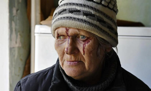 റഷ്യയെ യുദ്ധകുറ്റ നിയമത്തിന് മുന്നിൽ കൊണ്ടുവരണമെന്ന് ആംനസ്റ്റി ഇന്‍റർനാഷണൽ