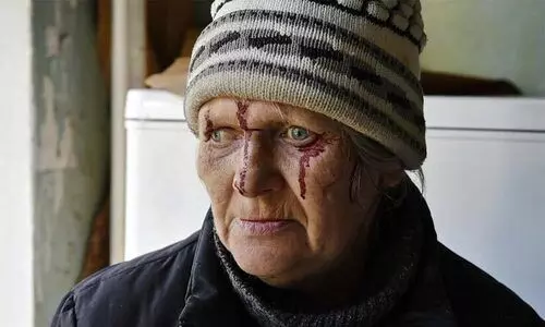 റഷ്യയെ യുദ്ധകുറ്റ നിയമത്തിന് മുന്നിൽ കൊണ്ടുവരണമെന്ന് ആംനസ്റ്റി ഇന്‍റർനാഷണൽ