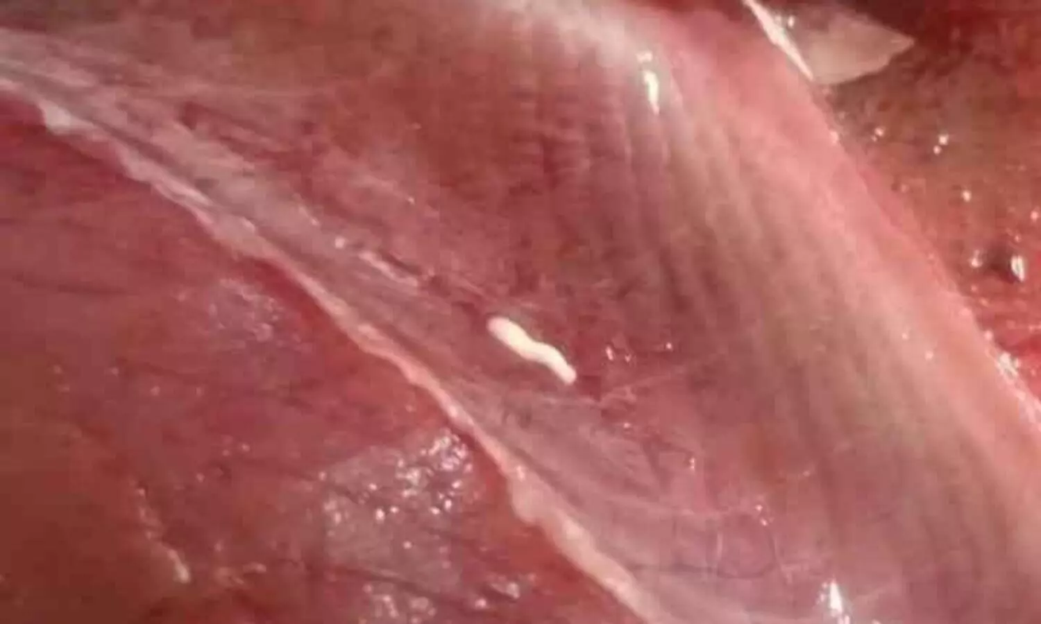 ചന്തയിൽ നിന്നു വാങ്ങിയ മീനിൽ പുഴു; പരാതി നൽകി