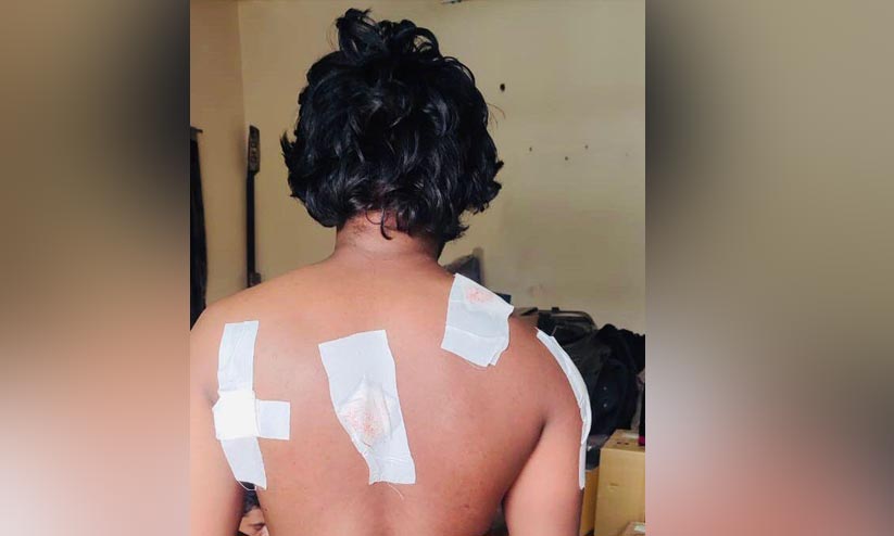 മലയാളി യുവാവിന് സൗദിയിൽ കുത്തേറ്റു മലയാളി യുവാവിന് സൗദിയിൽ കുത്തേറ്റു