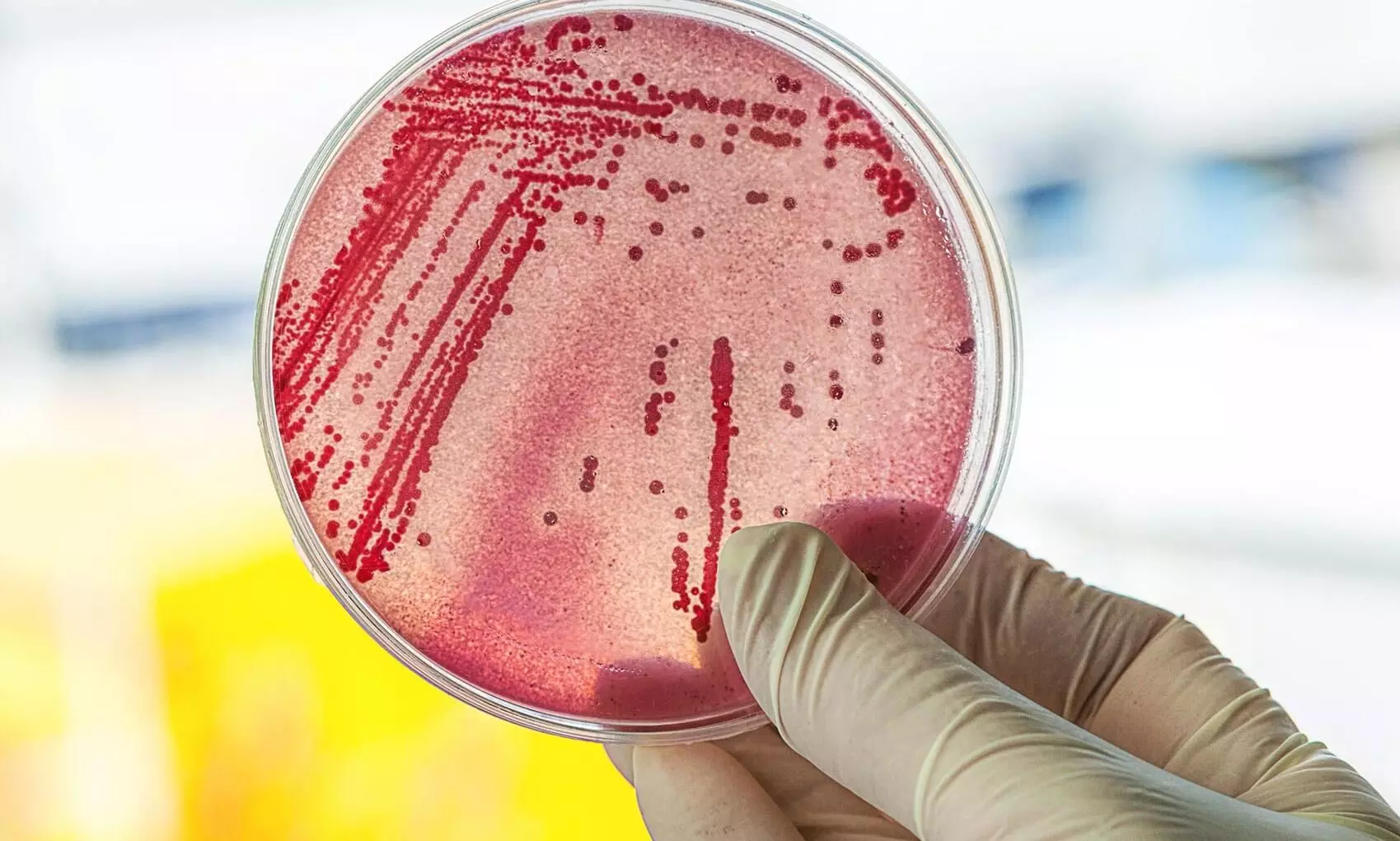 Coliform bacteria