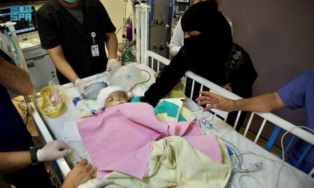 Siamese twins surgery Siamese twins surgery