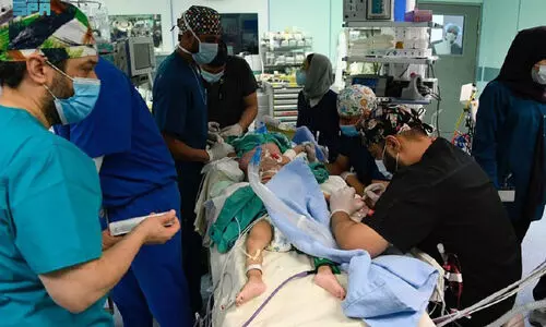 സ​യാ​മീ​സ്​ ഇ​ര​ട്ട​ക​ളു​ടെ ശ​സ്​​ത്ര​ക്രി​യ; യൂ​സു​ഫി​നും യാ​സീ​നും ഇ​നി ര​ണ്ട്​ ജീ​വി​തം