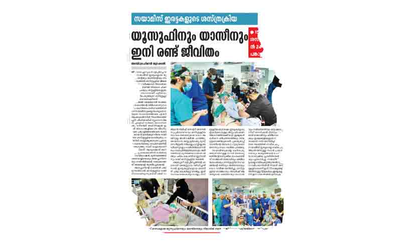 യമനി സയാമീസ് ഇരട്ടകളിലൊരാൾ മരിച്ചു യമനി സയാമീസ് ഇരട്ടകളിലൊരാൾ മരിച്ചു