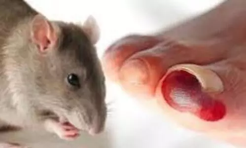 എലിപ്പനി ബാധിതർ വർധിക്കുന്നു: ജാഗ്രത പുലര്‍ത്തണമെന്ന് ആരോഗ്യ വകുപ്പ്