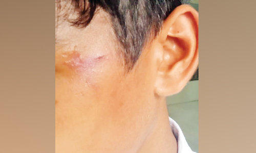 ല​ക്കി​ടി ന​വോ​ദ​യ സ്‌​കൂ​ളി​ൽ സീ​നി​യ​ർ വി​ദ്യാ​ർ​ഥി​ക​ളു​ടെ മ​ർ​ദ​ന​ത്തി​ൽ ആ​റു​പേ​ർ​ക്ക്​ പ​രി​ക്ക്​