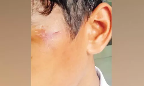 ല​ക്കി​ടി ന​വോ​ദ​യ സ്‌​കൂ​ളി​ൽ സീ​നി​യ​ർ വി​ദ്യാ​ർ​ഥി​ക​ളു​ടെ മ​ർ​ദ​ന​ത്തി​ൽ ആ​റു​പേ​ർ​ക്ക്​ പ​രി​ക്ക്​