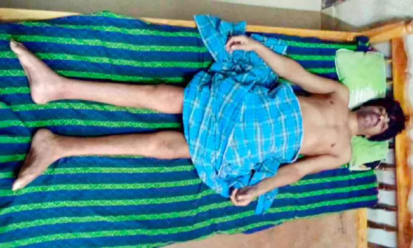 സുരേഷിന് വേണം സുമനസ്സുകളുടെ സഹായം സുരേഷിന് വേണം സുമനസ്സുകളുടെ സഹായം