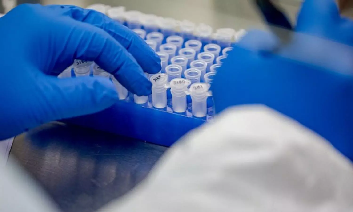 സൗദിയിൽ 135 പേർക്ക് കോവിഡ്, 131 പേർക്ക് രോഗമുക്തി