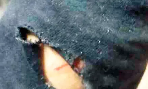 തെരുവുനായുടെ ആക്രമണത്തിൽ വിദ്യാർഥിക്ക് പരിക്ക്