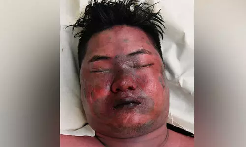 Dubai Unidentified body