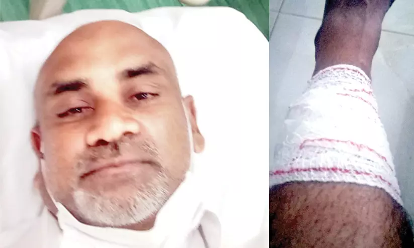 അബൂദബി പൊട്ടിത്തെറി: സാദിഖിന്‍റെ പിന്‍കാലില്‍ ചില്ല് തുളച്ചു കയറിയത് രക്ഷപ്പെട്ട് ഓടുന്നതിനിടെ